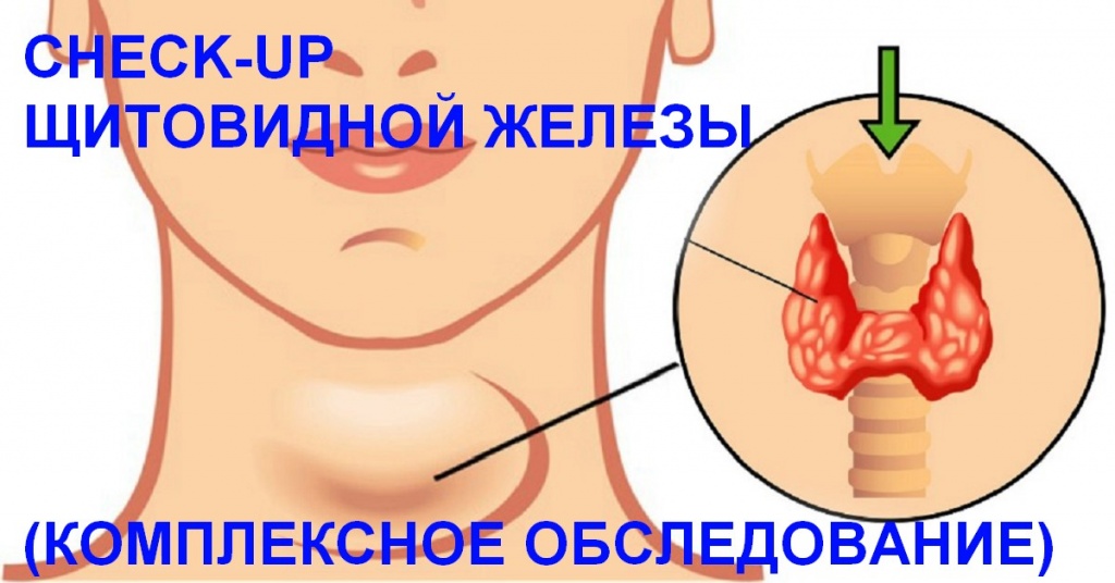 ���������� ������