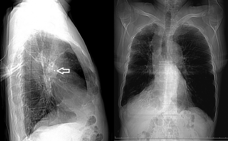 ���� � ����� �������