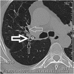 ���� � ����� �������