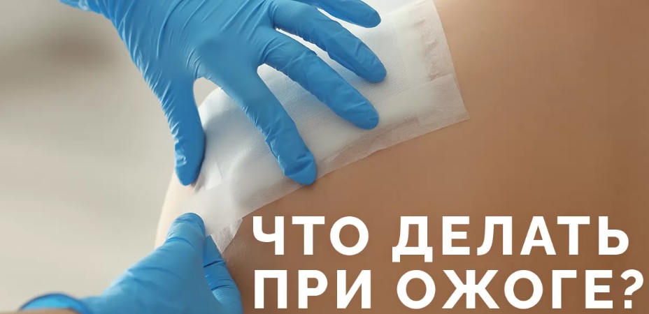 Лечение и первая помощь при ожогах Лечение и первая помощь при ожогах