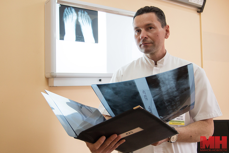 подагра подагра