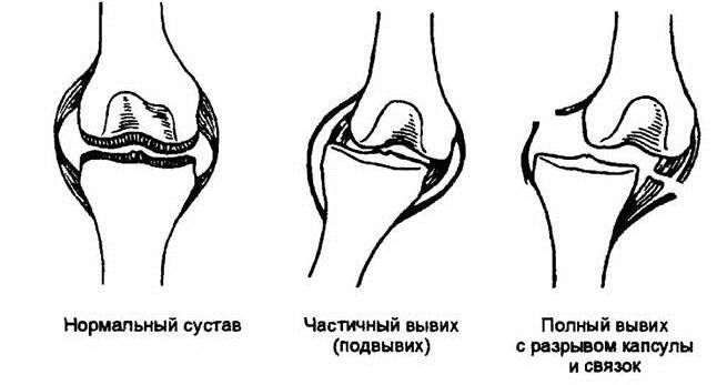 онеош онеош